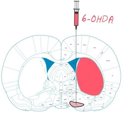 Bilateral Intracranial Beta Activity During Forced and Spontaneous Movements in a 6-OHDA Hemi-PD Rat Model